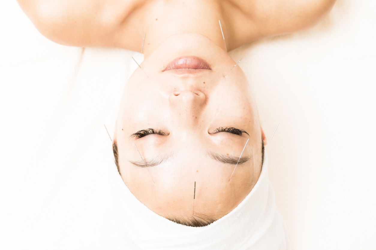 Beauty acupuncture to oriental women